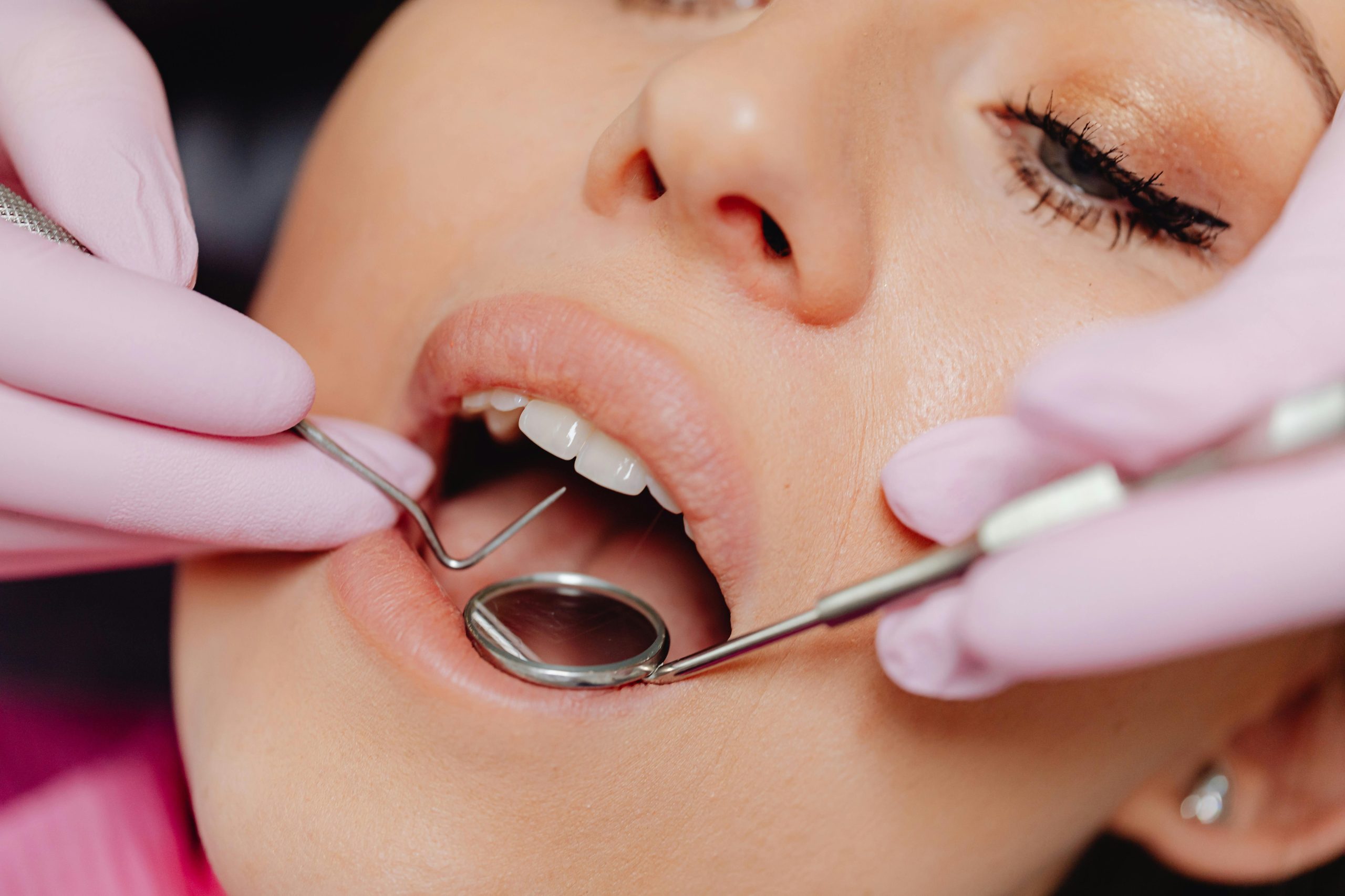 Implantes dentales en Zaragoza: Los beneficios estéticos y emocionales de una sonrisa completa
